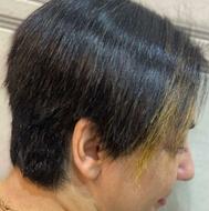 کراتین ،بوتاکس، پروتین