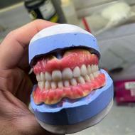 دندان مصنوعی و روکش و لمینت با نازل ترین قیمت