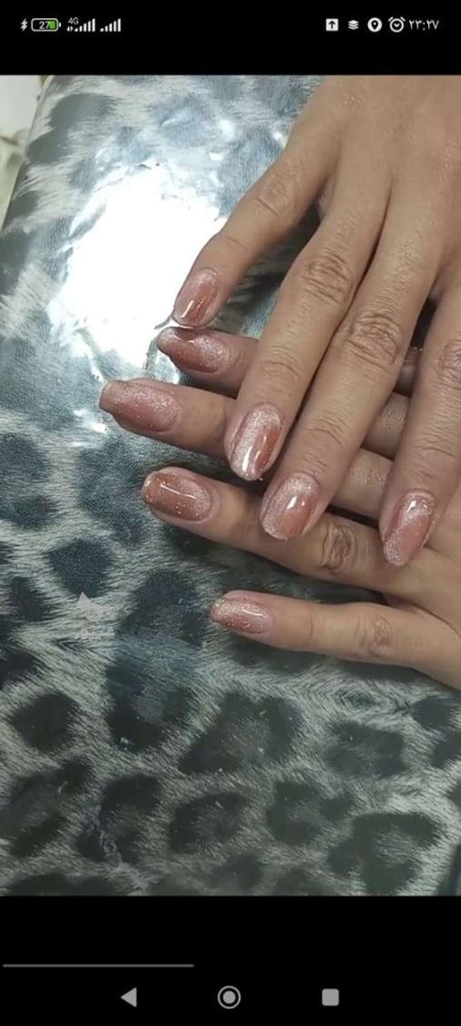 کاشت و ژلیش حرفه ای