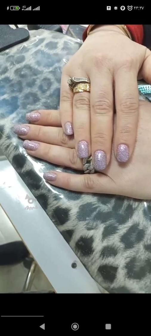 کاشت و ژلیش حرفه ای