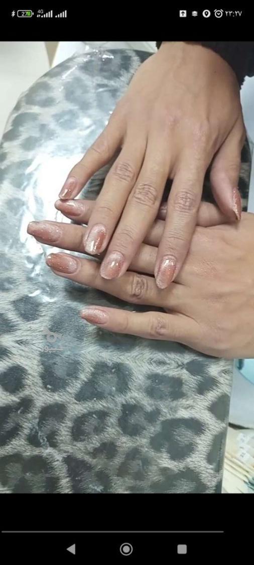 کاشت و ژلیش حرفه ای