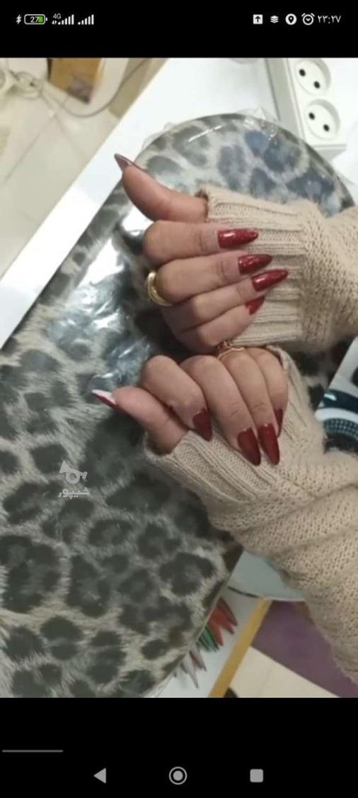 کاشت و ژلیش حرفه ای