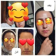 سرم جوانساز