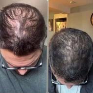 فروش انواع اکسیر ها ضد ریزش پرپشتی رویش مجدد موخوره شوره وزی