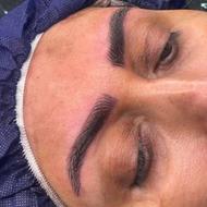 فیبروز ابرو به مدت یک هفته 50درصد تخفیف