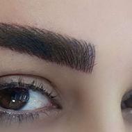 میکرو فیبروز فقط تا یلدا