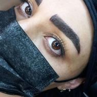 فیبروز و میکروبلیدینگ تخفیف یلدایی