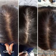 روغن تقویت مژه ابرو مو