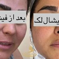 آموزش فشیال با قیمت مناسب