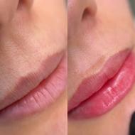 تخفیف شیدینگ لب