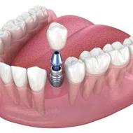 استخدام اپراتور لابراتواردندانساری خانوم