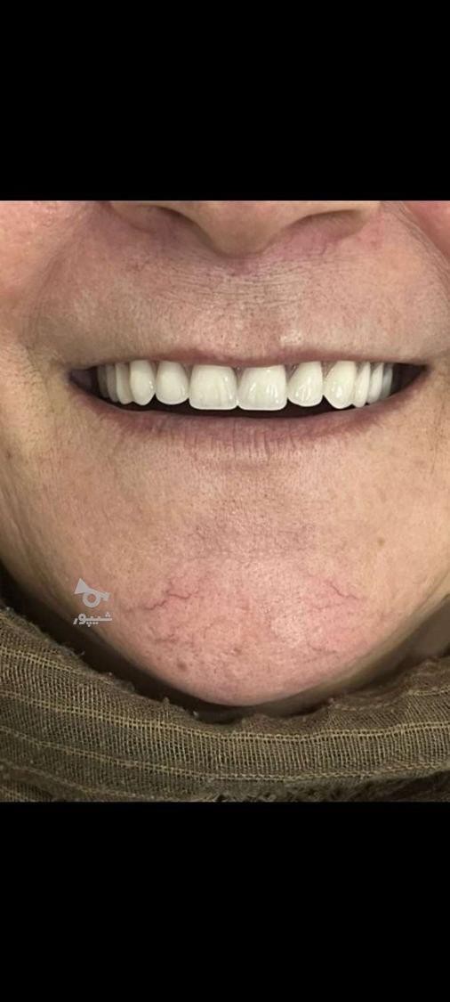 دندانسازی نجف اباد محمودی کیا