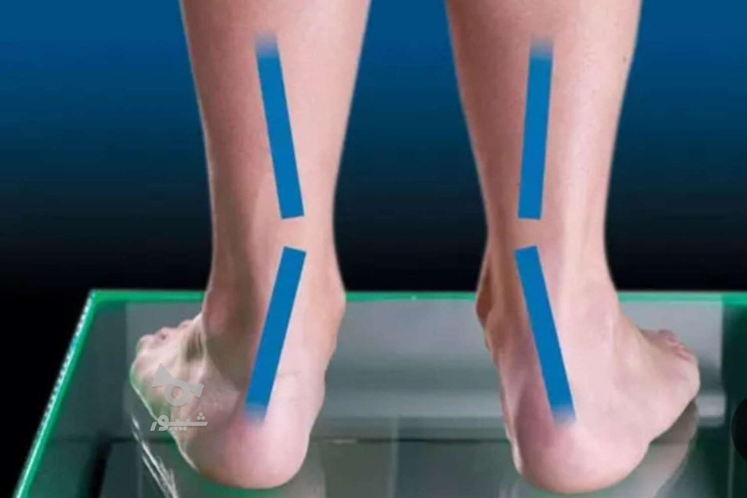 مرکز ارتوپدی بهبود غیرجراحی مشکلات راه رفتن