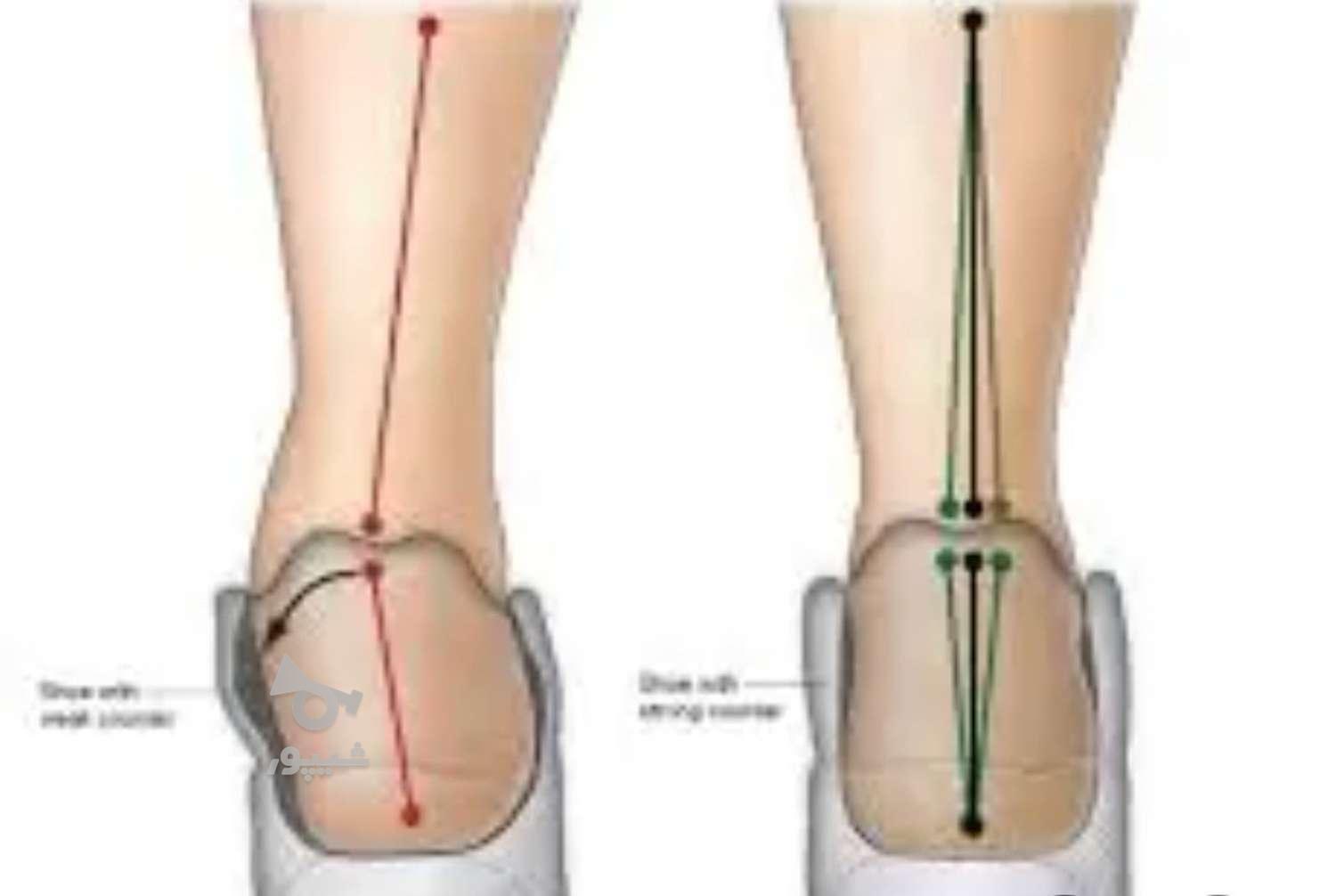 مرکز ارتوپدی بهبود غیرجراحی مشکلات راه رفتن