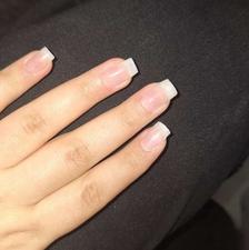 مدل کاشت و ترمیم ناخن (رایگان)