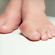 کلینیک تخصصی درمان هالوکس والگوس (شصت پای کج)