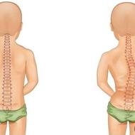 مرکز درمان قوز،گودی کمر،انحراف ستون فقرات و انحراف لگن