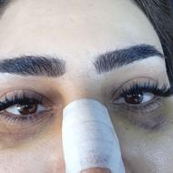 اکسیشن مژه فقط فقط 180با بهترین خدمات روز