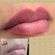 انجام تاتوصورت..سوراخ کردن گوش بادستگاه .پاک کردن تاتو.....