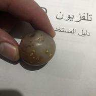 سنگ کلکسیونی