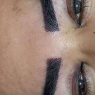 کاشت ابروی طبیعی