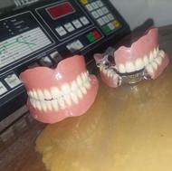 ساخت پروتز متحرک/دندان مصنوعی