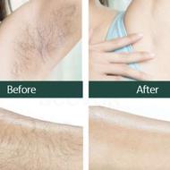 پکیج تخصصی رفع موی زائد️