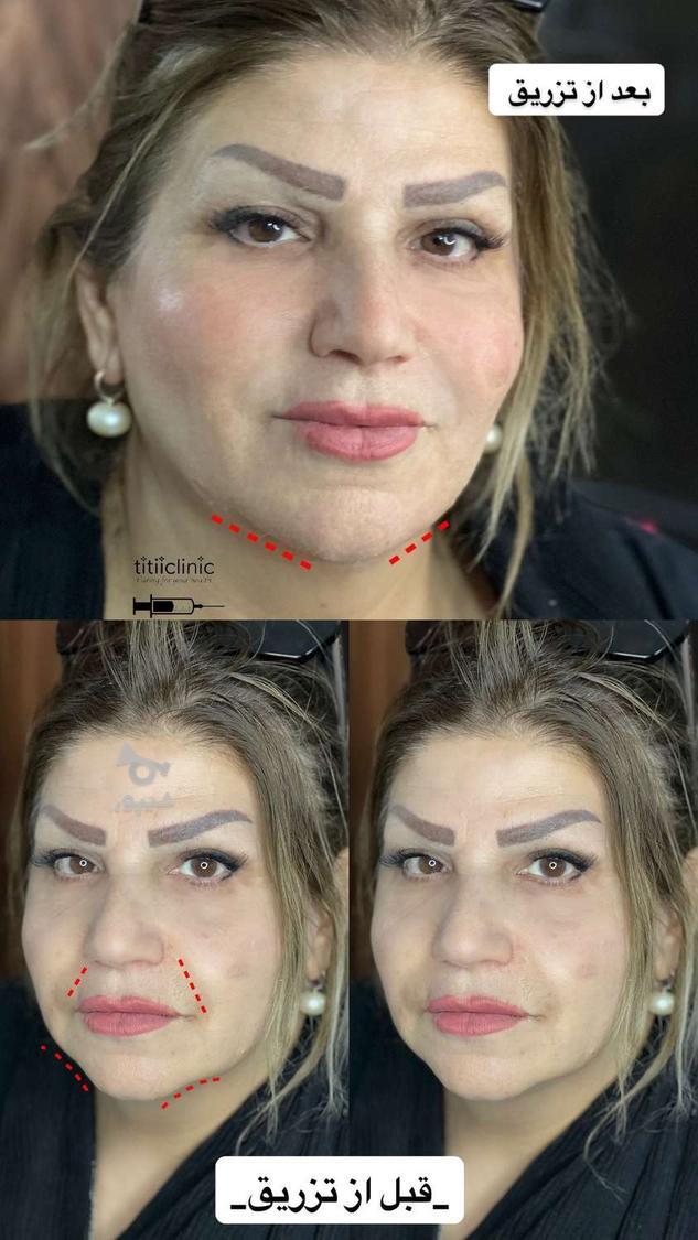 فقط هزینه مواد جهت تکمیل البوم