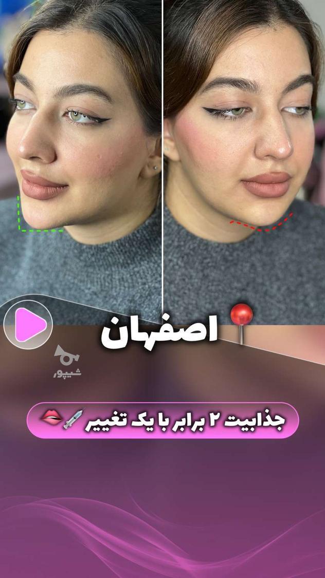 فقط هزینه مواد جهت تکمیل البوم