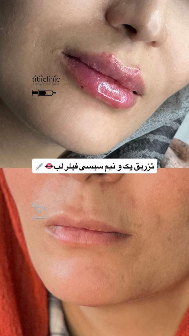 فقط هزینه مواد جهت تکمیل البوم