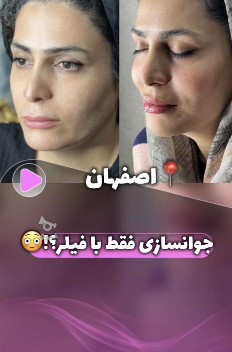 فقط هزینه مواد جهت تکمیل البوم