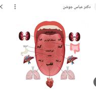 تشخیص ودرمان بیماری ها از روی عکس زبان