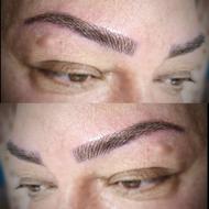 میکرو بلیدینگ