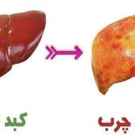 کبدت خیلی چربه بیا کمکت کنم