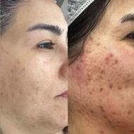 فیشال درمانی