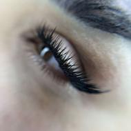 کاشت مژه فقط 380تا400