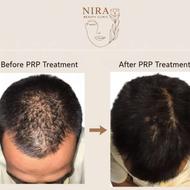 پروسیجر های زیبایی با قیمت مناسب