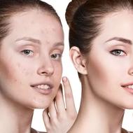 فوتوشاپ حرفه ای عکس، روتوش، فوتوشاپ اندام و بینی