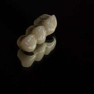 نیاز به تکسین دندانسازی