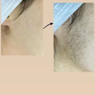 فیشال وپاکسازی عمیق پوست