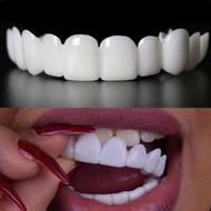 لمینت مترحک دندان