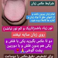 سونوگرافی دقیق داخلی
