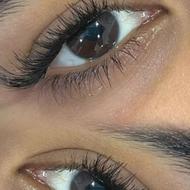 کاشت مژه طبیعی