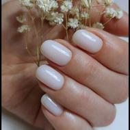 خدمات رایگان کاشت ترمیم ژلیش لمینیت