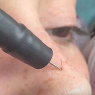 درمان تخصصی لک و کک ومک