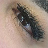 کاشت مژه سلاله