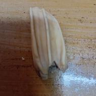 دندان قدیمی