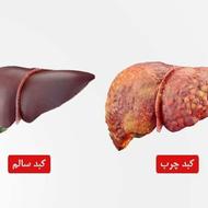 بهبود کبد چرب مرگ خاموش