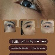 لیفت مژه و ابرو