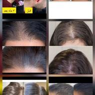 لاغری وتناسب اندام